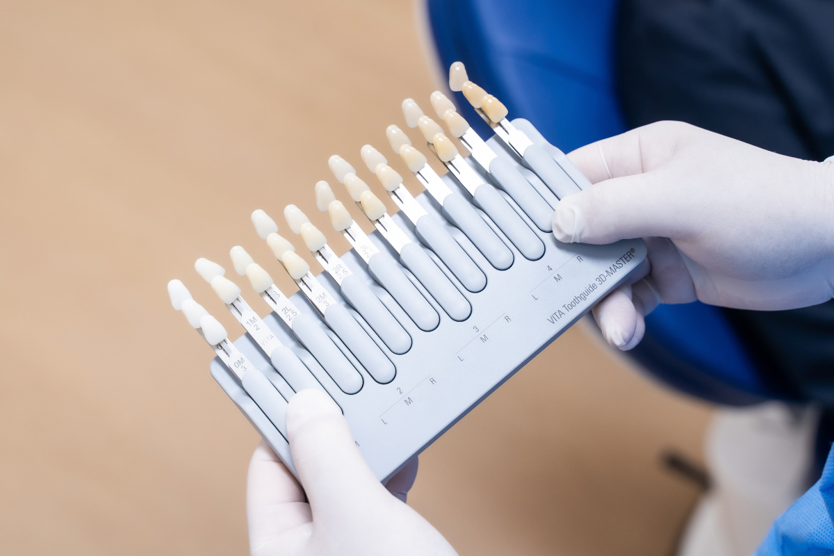Shade matching before composite or porcelain veneer treatment at a dental clinic in Singapore